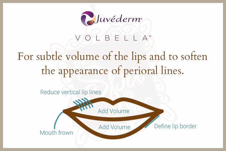 Volbella at Albuquerque's Western Dermatology Consultants is a versatile filler with several applications in and around the lips